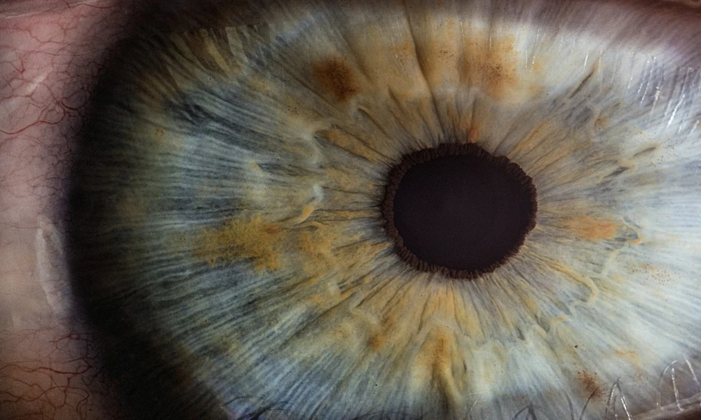 The Signs Your Eyes Might Need More Support